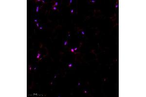Immunofluorescence of paraffin embedded rat fat using TBCldl (ABIN7075843) at dilution of 1:1000 (300x lens)