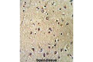 Immunohistochemistry (IHC) image for anti-Karyopherin (Importin) beta 1 (KPNB1) antibody (ABIN3002817) (KPNB1 anticorps)