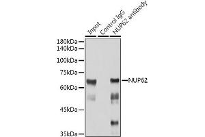 Immunoprecipitation analysis of 300 μg extracts of Jurkat cells using 3 μg NUP62 antibody (ABIN7269045). (NUP62 anticorps)