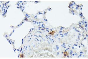 Immunohistochemistry of paraffin-embedded Rat lung using TIAL1 Polyclonal Antibody at dilution of 1:100 (40x lens). (TIAL1 anticorps)