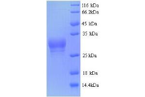 SDS-PAGE (SDS) image for Probable Serine/threonine-Protein Phosphatase 2A Regulatory Subunit B'' Subunit TON2 (FASS) (AA 1-28), (full length) protein (GST tag) (ABIN5714198) (GDO Protein (AA 1-28, full length) (GST tag))