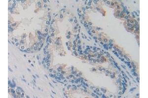 Detection of SCGN in Human Prostate Tissue using Polyclonal Antibody to Secretagogin (SCGN)