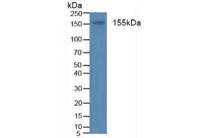 Figure. (Insulin Receptor anticorps  (AA 1024-1298))