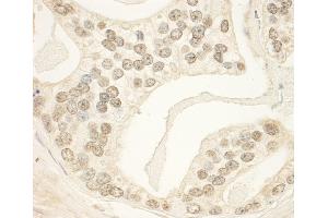 anti-PHD Finger Protein 23 (PHF23) (AA 353-403) antibody