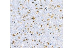Immunohistochemistry of paraffin embedded mouse brain using MAP7 (ABIN7074621) at dilution of 1:600 (300x lens)