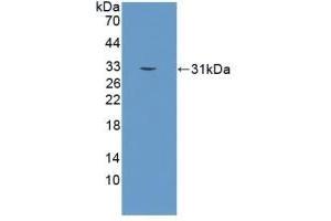 Detection of Recombinant KLK2, Human using Polyclonal Antibody to Kallikrein 2 (KLK2) (Kallikrein 2 anticorps  (AA 19-261))