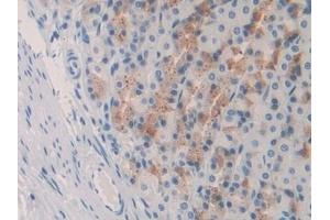 Detection of IL10 in Rat Stomach Tissue using Monoclonal Antibody to Interleukin 10 (IL10) (IL-10 anticorps  (AA 19-178))