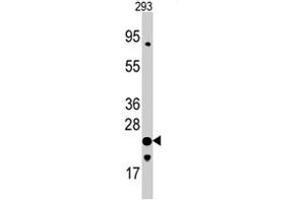 Western blot analysis of FXN polyclonal antibody  in 293 cell line lysates (35 ug/lane).