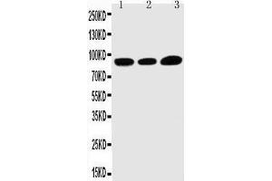 Anti-TRPV3 antibody, Western blotting Lane 1: HELA Cell Lysate Lane 2: A549 Cell Lysate Lane 3: MCF-7 Cell Lysate (TRPV3 anticorps  (C-Term))