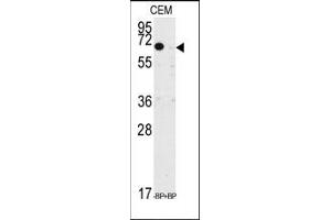 Image no. 2 for anti-Kruppel-Like Factor 10 (KLF10) (AA 19-49), (N-Term) antibody (ABIN360044) (KLF10/TIEG1 anticorps  (N-Term))