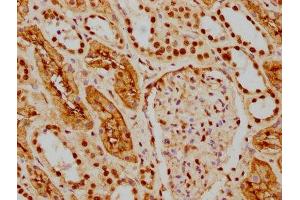 IHC image of ABIN7127541 diluted at 1:154 and staining in paraffin-embedded human kidney tissue performed on a Leica BondTM system. (Recombinant HDAC9 anticorps)
