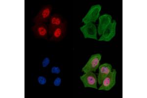 ABIN6256554 and ABIN6267250 staining Hela cells(30 min of UV treatment) by IF/ICC. (CHEK2 anticorps  (pThr387))