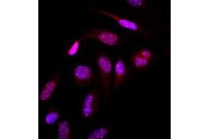 Immunofluorescence of human HeLa cells stained with Hoechst 3342 (Blue) for nucleus staining and monoclonal anti-human SUMO2/3 antibody (1:500) with Texas Red (Red).