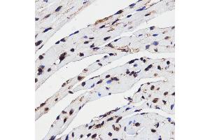 Immunohistochemistry of paraffin-embedded mouse heart using HMGB1 antibody (ABIN3059694) at dilution of 1/100 (40x lens). (HMGB1 anticorps)
