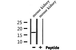 Western blot analysis of extracts from mouse kidney, using NDUFA13 Antibody.