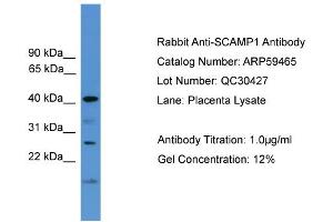 WB Suggested Anti-SCAMP1  Antibody Titration: 0. (SCAMP1 anticorps  (Middle Region))