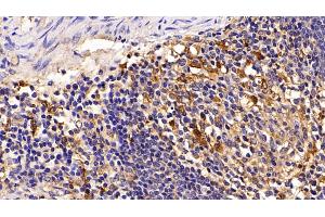 Detection of CTSS in Porcine Spleen Tissue using Polyclonal Antibody to Cathepsin S (CTSS) (Cathepsin S anticorps  (AA 115-331))