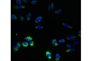 Immunofluorescent analysis of HepG2 cells using ABIN7151184 at dilution of 1:100 and Alexa Fluor 488-congugated AffiniPure Goat Anti-Rabbit IgG(H+L)