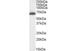 ABIN334405 (1µg/ml) staining of Mouse Brain lysate (35µg protein in RIPA buffer). (GAD anticorps  (Internal Region))