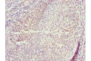 Immunohistochemistry of paraffin-embedded human tonsil tissue using ABIN7173433 at dilution of 1:100 (TRIM29 anticorps  (AA 309-588))