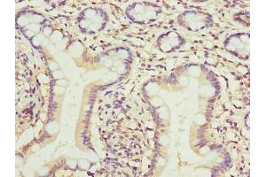 Immunohistochemistry of paraffin-embedded human small intestine tissue using ABIN7173079 at dilution of 1:100 (TMEM154 anticorps  (AA 97-183))