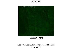 Sample Type :  Rhesus macaque spinal cord  Primary Antibody Dilution :  1:300  Secondary Antibody :  Donkey anti Rabbit 488  Secondary Antibody Dilution :  1:500  Color/Signal Descriptions :  Green: ATP2A2  Gene Name :  APLP2  Submitted by :  Timur Mavlyutov, Ph. (ATP2A2 anticorps  (C-Term))