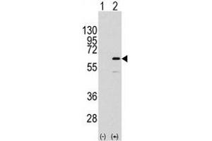 Western blot analysis of ELK1 (arrow) using rabbit polyclonal ELK1 Antibody  (R). (ELK1 anticorps  (AA 361-390))