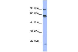 WB Suggested Anti-LRRFIP1 Antibody Titration:  0. (LRRFIP1 anticorps  (N-Term))