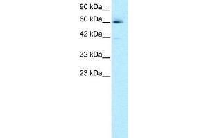 WB Suggested Anti-HCLS1 Antibody Titration:  0. (HCLS1 anticorps  (N-Term))