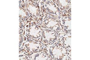 Immunohistochemical analysis of paraffin-embedded human colon tissue using C performed on the Leica® BOND RXm. (NOX1 anticorps  (AA 243-271))