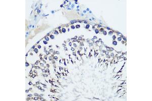 Immunohistochemistry of paraffin-embedded rat testis using CCR7 Rabbit mAb (ABIN7266309) at dilution of 1:100 (40x lens).