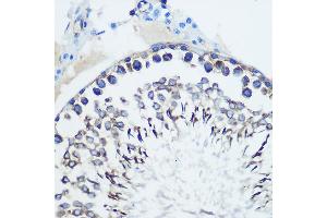 Immunohistochemistry of paraffin-embedded rat testis using CCR7 Rabbit mAb (ABIN7266309) at dilution of 1:100 (40x lens). (CCR7 anticorps)