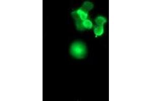 anti-Sex Determining Region Y (SRY) antibody