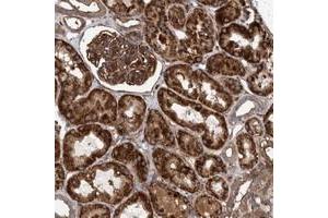 Immunohistochemical staining of human kidney with MRPL12 polyclonal antibody  shows strong cytopmasmic positivity with granular pattern in cells in tubules and cells in glomeruli. (SLC25A10 anticorps)