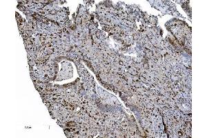 IHC analysis of MCM6 using anti-MCM6 antibody (ABIN7600036). (MCM6 anticorps  (AA 14-821))