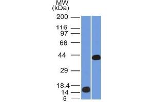 Western Blot (1) Recombinant AMACR and (2) Human Kidney lysate using AMACR / p504S Mouse Monoclonal Antibody (AMACR/1864).
