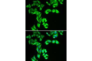 Immunofluorescence analysis of HeLa cell using STRN3 antibody. (STRN3 anticorps)