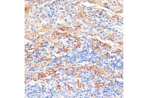 Immunohistochemistry of paraffin-embedded rat spleen using APCS antibody (ABIN3022713, ABIN3022714, ABIN3022715, ABIN1512583 and ABIN6219158) at dilution of 1:100 (40x lens).
