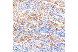 Immunohistochemistry of paraffin-embedded rat spleen using APCS antibody (ABIN3022713, ABIN3022714, ABIN3022715, ABIN1512583 and ABIN6219158) at dilution of 1:100 (40x lens). (APCS anticorps  (AA 1-223))