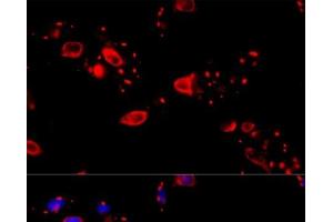 Immunofluorescence analysis of HeLa cells using CCT8 Polyclonal Antibody at dilution of 1:100 (40x lens). (CCT8 anticorps)