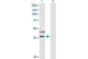 Western Blot analysis of IL2RG expression in transfected 293T cell line by IL2RG MaxPab polyclonal antibody. (IL2RG anticorps  (AA 1-369))
