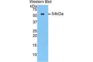 Western Blotting (WB) image for anti-Cholesterol Esterase (CEL) (AA 117-361) antibody (ABIN1858172) (Cholesterol Esterase anticorps  (AA 117-361))