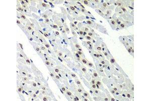 Immunohistochemistry of paraffin-embedded Rat heart using SF3B2 Polyclonal Antibody at dilution of 1:100 (40x lens).