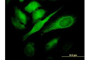Immunofluorescence of monoclonal antibody to TBC1D8 on HeLa cell. (TBC1D8 anticorps  (AA 1-110))