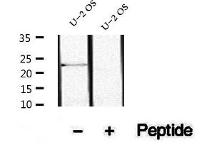 Western blot analysis of extracts of U-2 OS cells, using Phospho-TCTP (Ser46) Antibody.