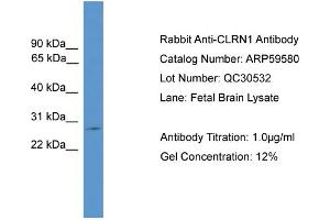 WB Suggested Anti-CLRN1  Antibody Titration: 0. (Clarin 1 anticorps  (C-Term))