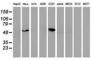 Image no. 7 for anti-Tumor Protein P53 (TP53) antibody (ABIN1499972) (p53 anticorps)
