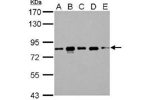 WB Image CD2AP antibody detects CD2AP protein by Western blot analysis. (CD2AP anticorps)