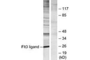 Western blot analysis of extracts from Jurkat cells, using Flt3 ligand Antibody. (FLT3LG anticorps  (AA 171-220))