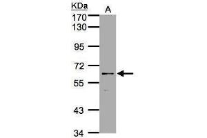 WB Image Sample(30 ug whole cell lysate) A:A431, 7.